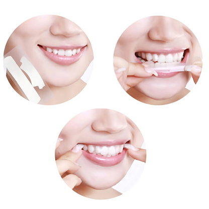 Smilumin – Set za njegu zubi s LED lampom i trakicama
